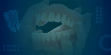Full Denture, Acrylic Teeth or healing (upper or lower)